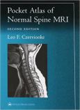 Pocket Atlas Of Normal Spine Mri